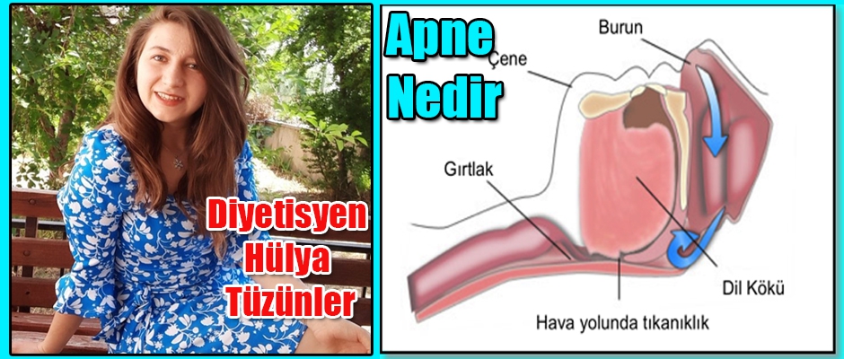 Diyetisyen Tüzünler yazdı Apne Nedir