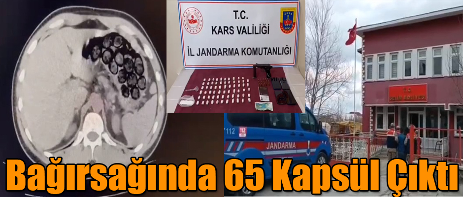 KARS'TA YAKALANAN ŞAHSIN BAĞIRSAĞINDA 65 KAPSÜL UYUŞTURUCU ÇIKTI