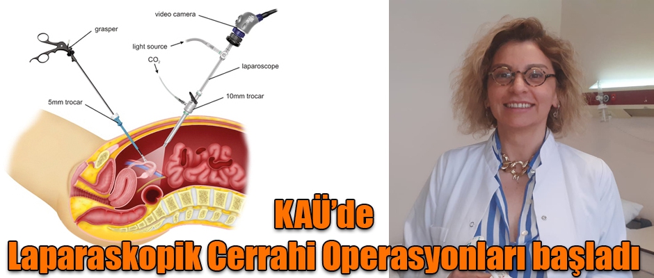 KAÜ’de Laparaskopik Cerrahi Operasyonları Başladı