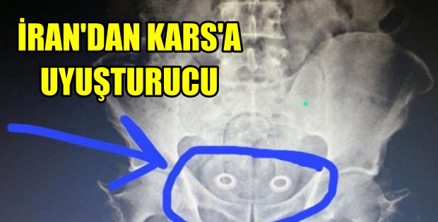 İRAN'DAN KARS'A MİDE İÇİNDE UYUŞTURUCU SEVKİYATI