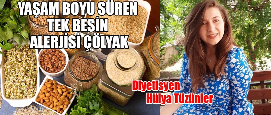 Yaşam Boyu Süren Tek Besin Alerjisi Çölyak